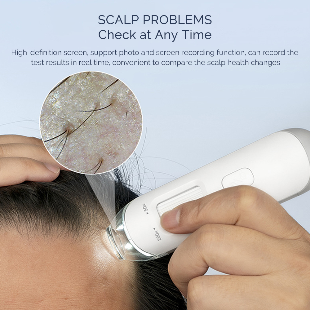 Visual Dermatoscope Scalp Dete - Electronics Quiz บทวิจารณ์และราคา
